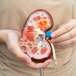 fungsi organ ekskresi manusia.